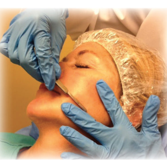 Dermaplaning Blade - Image 2